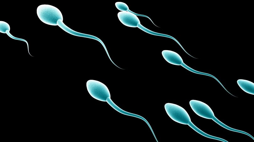 Мањак сперматозоида (Википедија)